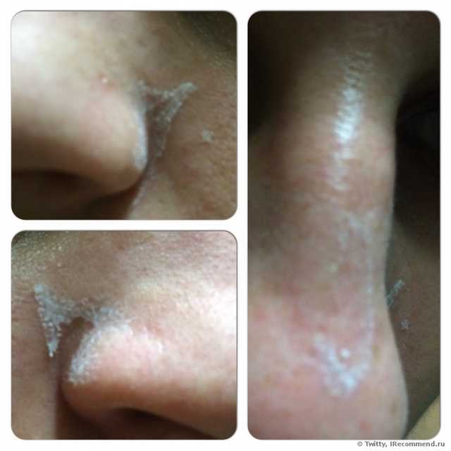 Полоски для носа тони моли отзывы клубника. ochishayushie poloski dlya nosa tony moly egg pore nose pack 31. Полоски для носа тони моли отзывы клубника фото. Полоски для носа тони моли отзывы клубника-ochishayushie poloski dlya nosa tony moly egg pore nose pack 31. картинка Полоски для носа тони моли отзывы клубника. картинка ochishayushie poloski dlya nosa tony moly egg pore nose pack 31. Рискнула использовать пластырь Tony Moly, потому что бездумно повелась на хорошие отзывы и поверила в чудо-действие корейской косметики. Оказалось, зря.