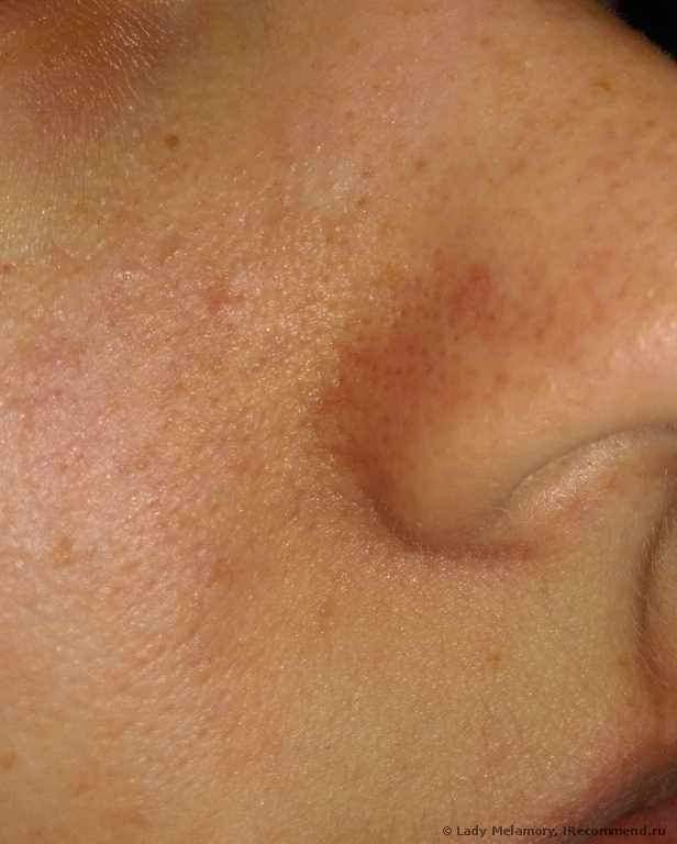 Полоски для носа тони моли отзывы клубника. ochishayushie poloski dlya nosa tony moly egg pore nose pack 40. Полоски для носа тони моли отзывы клубника фото. Полоски для носа тони моли отзывы клубника-ochishayushie poloski dlya nosa tony moly egg pore nose pack 40. картинка Полоски для носа тони моли отзывы клубника. картинка ochishayushie poloski dlya nosa tony moly egg pore nose pack 40. Рискнула использовать пластырь Tony Moly, потому что бездумно повелась на хорошие отзывы и поверила в чудо-действие корейской косметики. Оказалось, зря.