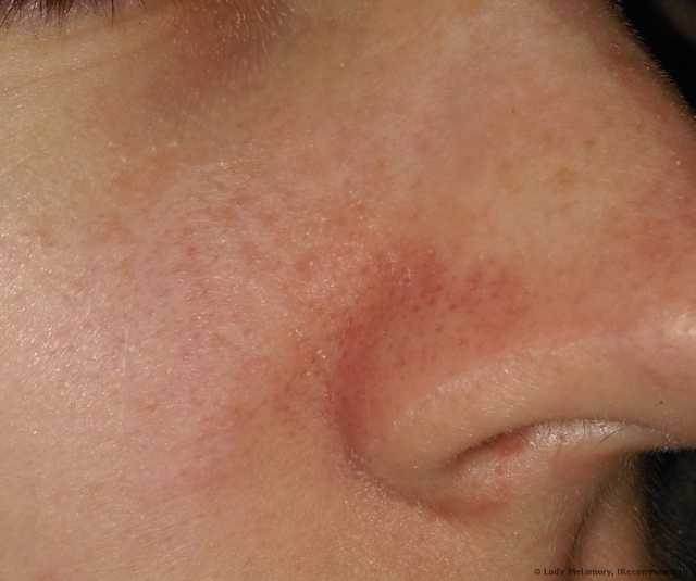 Полоски для носа тони моли отзывы клубника. ochishayushie poloski dlya nosa tony moly egg pore nose pack 41. Полоски для носа тони моли отзывы клубника фото. Полоски для носа тони моли отзывы клубника-ochishayushie poloski dlya nosa tony moly egg pore nose pack 41. картинка Полоски для носа тони моли отзывы клубника. картинка ochishayushie poloski dlya nosa tony moly egg pore nose pack 41. Рискнула использовать пластырь Tony Moly, потому что бездумно повелась на хорошие отзывы и поверила в чудо-действие корейской косметики. Оказалось, зря.