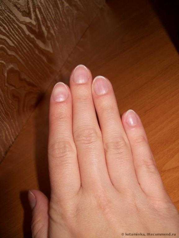 Что такое отвердитель для ногтей. Смотреть фото Что такое отвердитель для ногтей. Смотреть картинку Что такое отвердитель для ногтей. Картинка про Что такое отвердитель для ногтей. Фото Что такое отвердитель для ногтей