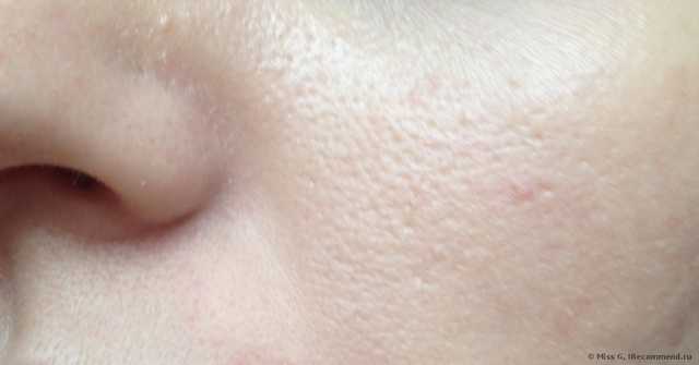 Крем для лица Avene TRIACNEAL  (Triacneal) - фото