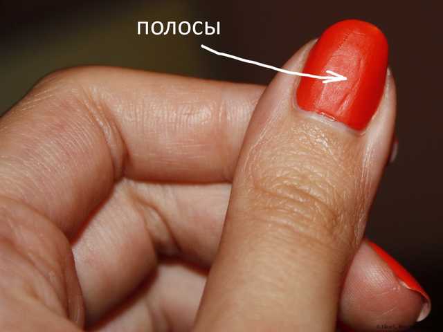 полосы
