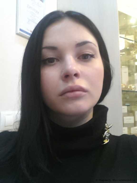 Juvederm Ultra 3. Почему именно он? Обновлён )