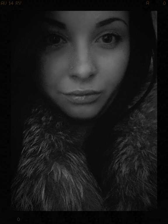 Juvederm Ultra 3. Почему именно он? Обновлён )