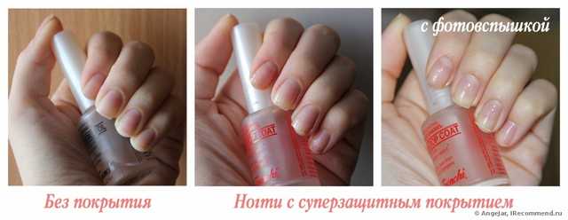 Суперзащитное покрытие Умная Эмаль витаминами А и Е - фото