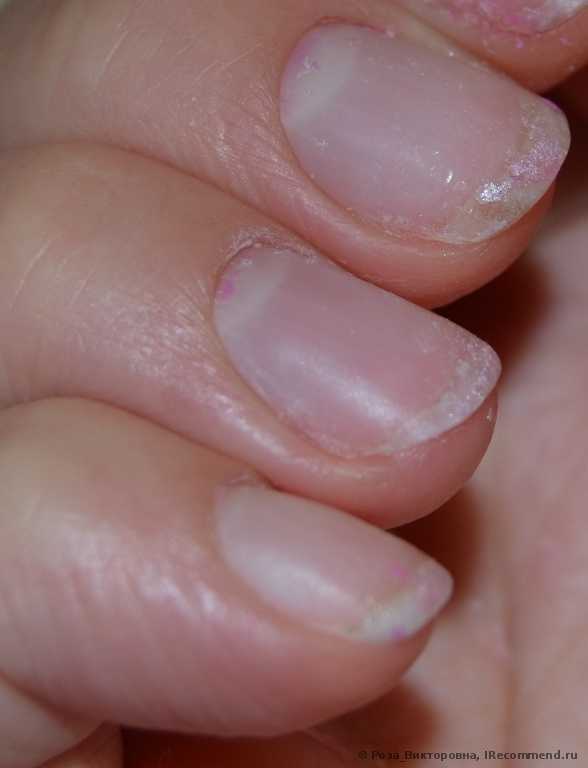 Жидкость для снятия гель-лака InGarden Artificial nail Remover - фото