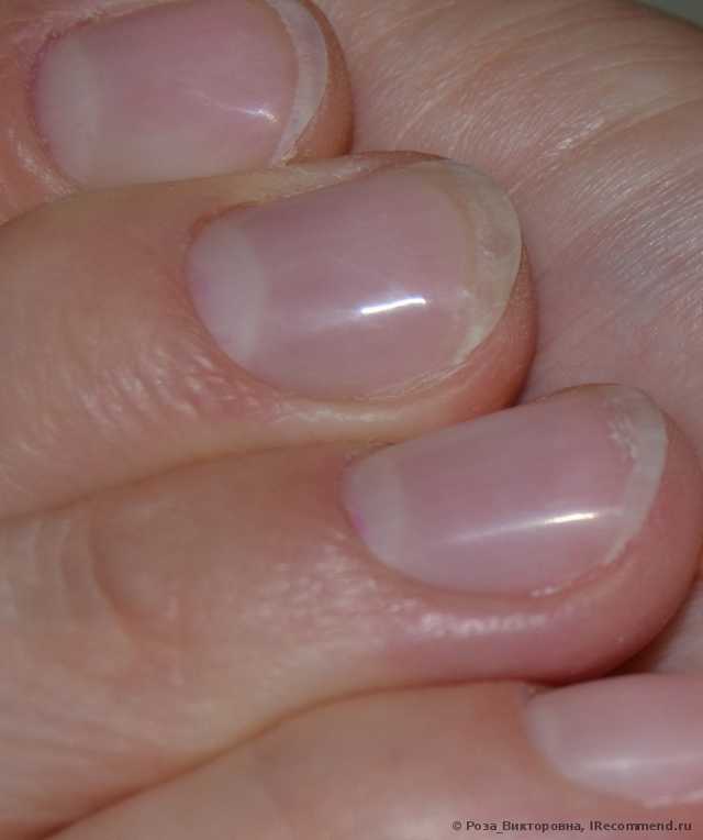 Жидкость для снятия гель-лака InGarden Artificial nail Remover - фото