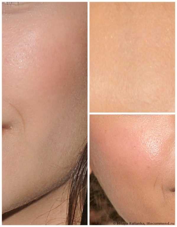 Тональный флюид Chanel Les beiges all in one healthy glow fluid spf 15 - фото