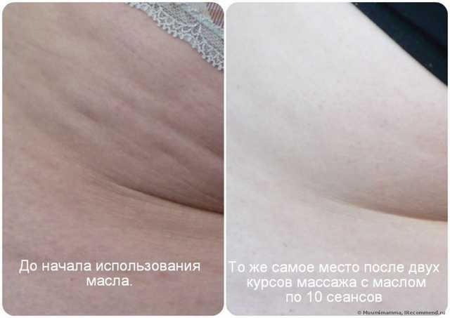 До и после курса массажа с маслом.
