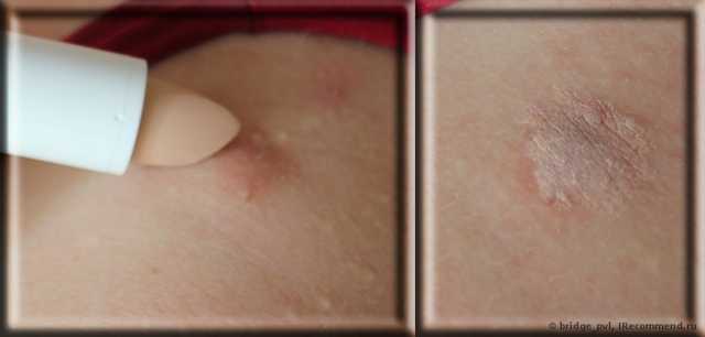 Маскирующий карандаш Clearskin