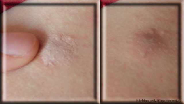 Маскирующий карандаш Clearskin. Растушевываю пальцем. Итог