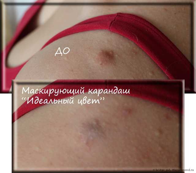 Маскирующий карандаш "Идеальный цвет" Fair. ДО и ПОСЛЕ