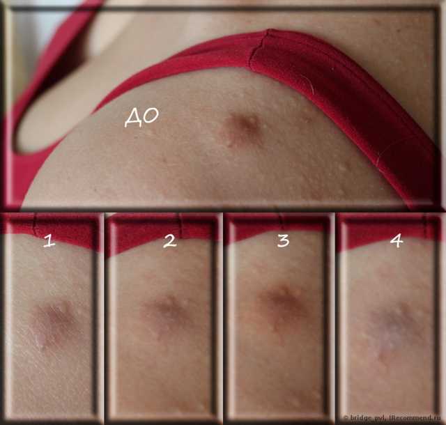 1 - консилер Light, 2 - карандаш Clearskin, 3 - консилер Medium, 4 - карандаш Fair