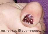 Ногти стали красивее, можно не ходит в салон а сделать маникюр дома!