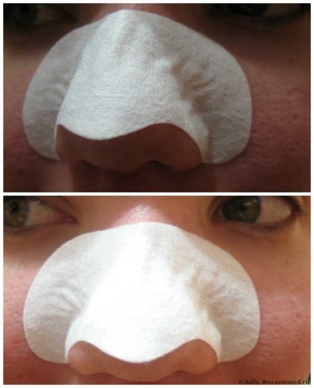 Очищающие полоски для носа L'action cosmetique с экстрактом чайного дерева Tea Tree Nose Pore Strips - фото