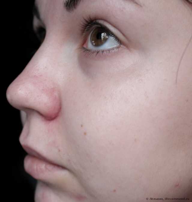 Крем увлажняющий L'Oreal Трио Актив Красота и Сияние Увлажняющий уход Здоровый цвет лица - фото