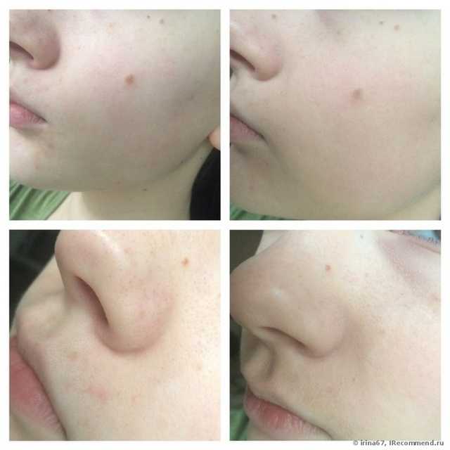 Тональная основа MAYBELLINE SuperStay Better Skin - фото