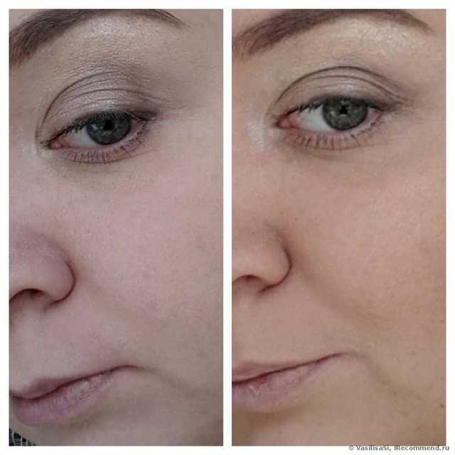 1-Better Skin 2-другой тональный крем
