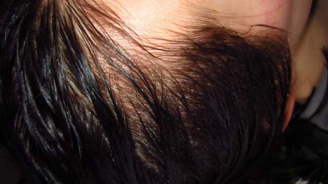 Оттеночный бальзам для волос  ACME color Рябина Ultra soft - фото
