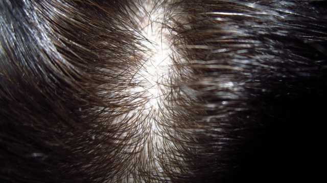 Оттеночный бальзам для волос  ACME color Рябина Ultra soft - фото
