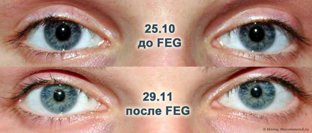 Мои скромные результаты спустя месяц + ФОТО до-после. Состав, огромный отзыв.