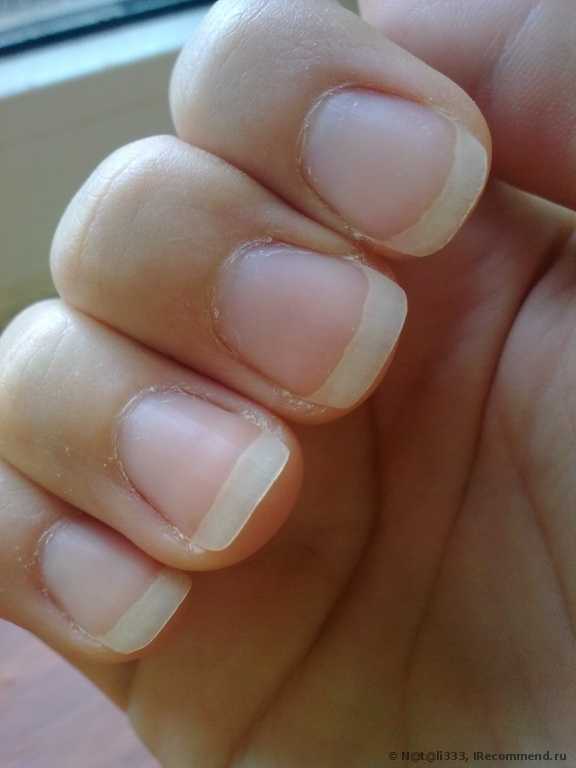 вот ногти спустя неделю(после применения)