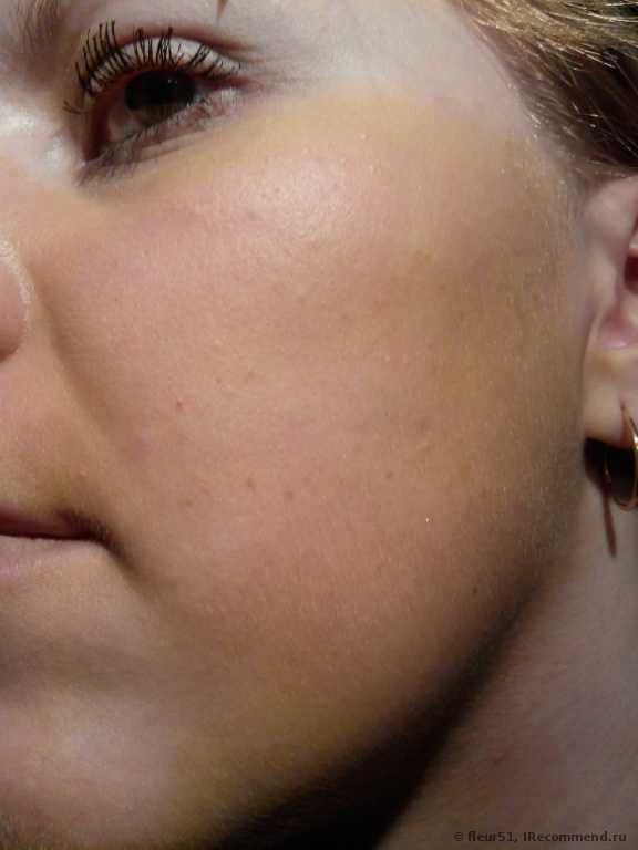 CC Cream Eveline комплексный успокаивающе-увлажняющий крем для сосудистой кожи 8 в 1 - фото