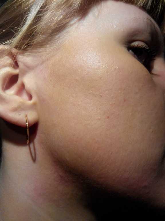 CC Cream Eveline комплексный успокаивающе-увлажняющий крем для сосудистой кожи 8 в 1 - фото