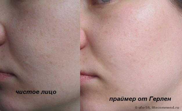 Основа под макияж Guerlain Meteorites Perles Light-Diffusing Perfecting Primer - фото
