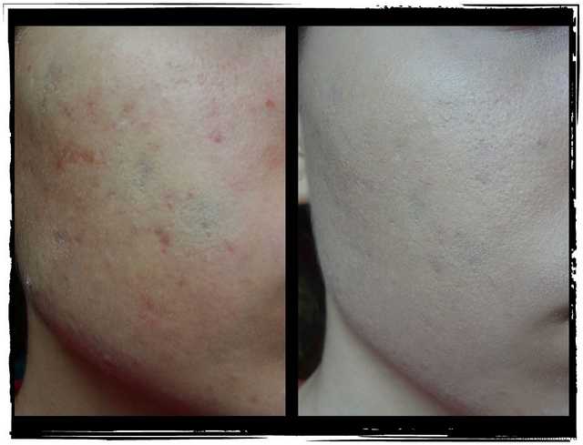 Тональный крем BelorDesign BB beauty cream - фото