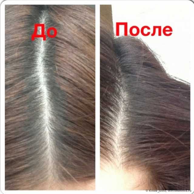 Лосьон CUTRIN Энергетический лосьон для волос - фото