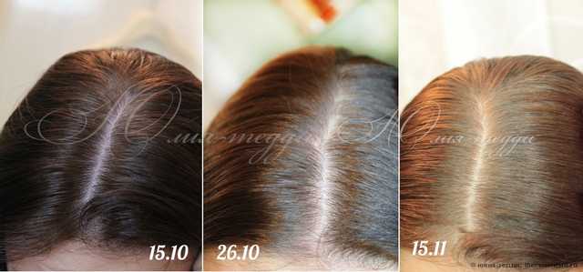 Лосьон CUTRIN Энергетический лосьон для волос - фото