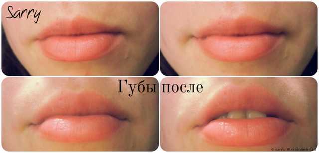 ? Два в одном! (+ фото стянутых губ ДО и ПОСЛЕ) ?