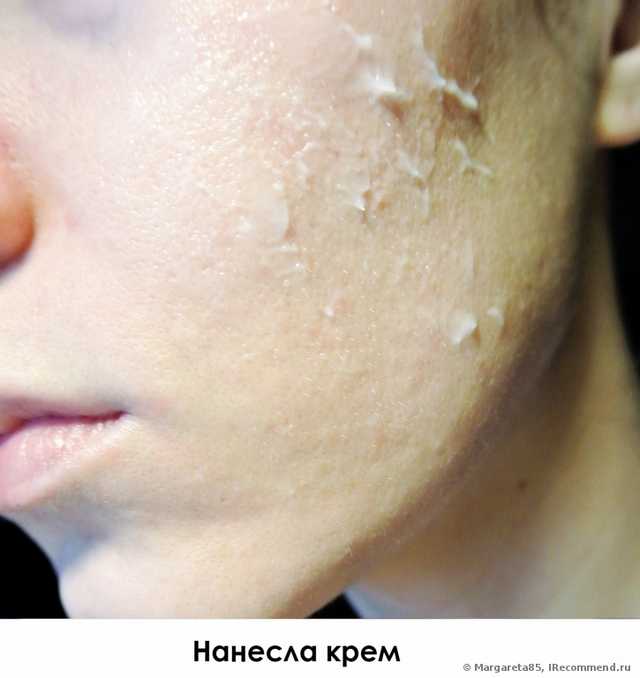 Интенсивный увлажняющий крем для лица  Nature Republic    Super Aqua Max Watery Cream - фото