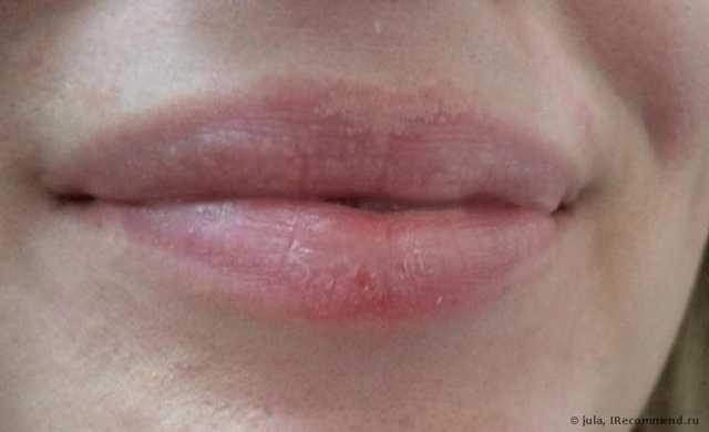 Бальзам для губ Belweder Желе для губ мультивитаминный - фото