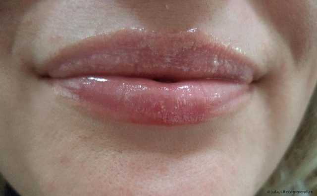 Бальзам для губ Belweder Желе для губ мультивитаминный - фото