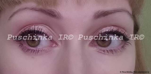 Инъекции ботокса - фото