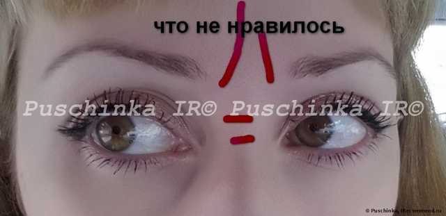 Инъекции ботокса - фото