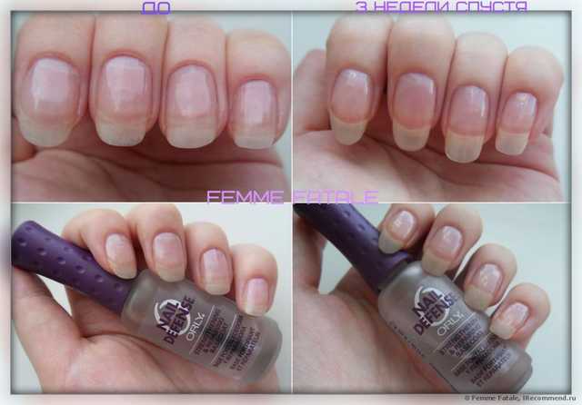 Средство для слоящихся ногтей  ORLY Nail Defense - фото
