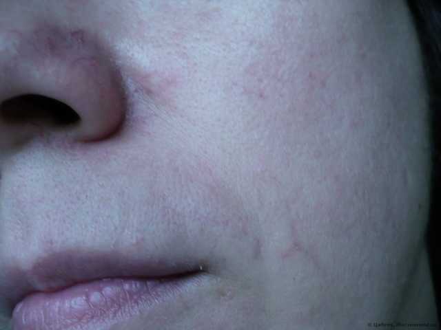 Крем для лица Кора капилляропротектор для кожи, склонной к куперозу - фото