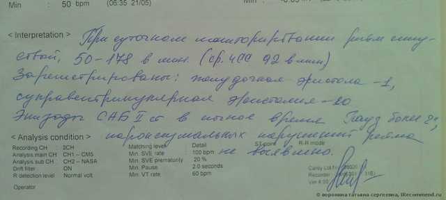 Метод основанный на регистрации кардиограммы в течение суток