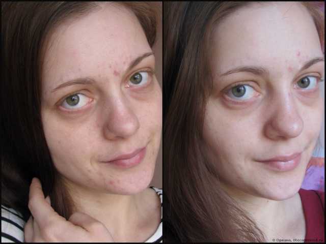 Гель для умывания Bioderma Sebium - Gel moussant purifiant - фото