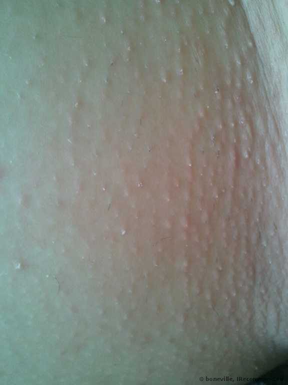 Эпилятор Braun  2075 Silk-epil EverSoft - фото