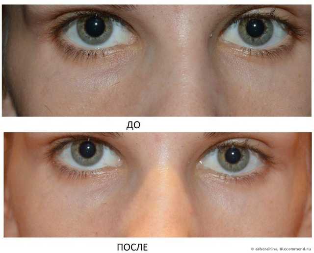 Маска для кожи вокруг глаз Белкосмекс Домашний косметолог Против "мешков" и кругов под глазами - фото