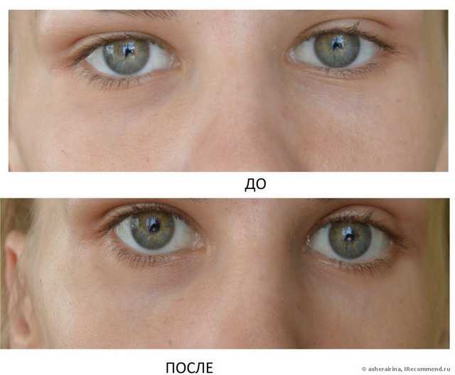 Маска для кожи вокруг глаз Белкосмекс Домашний косметолог Против "мешков" и кругов под глазами - фото