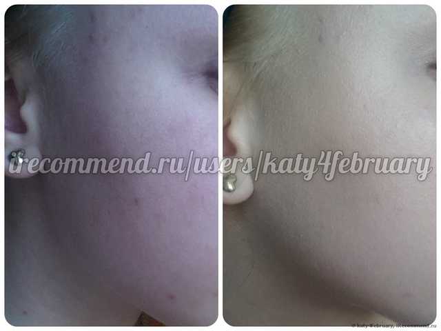ВВ крем SKIN79 Diamond Prestige Beblesh Balm SPF25 - фото