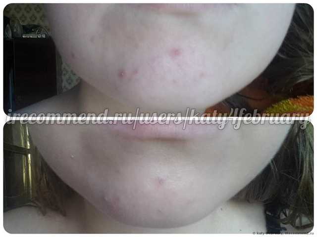ВВ крем SKIN79 Diamond Prestige Beblesh Balm SPF25 - фото