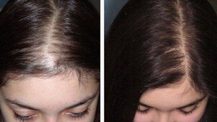 Hair Thick капли для пышных волос