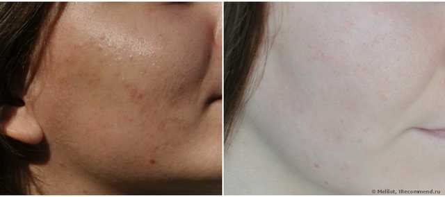 2010 и 2014