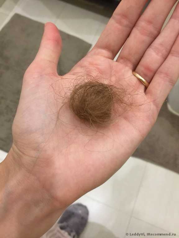 ÐолоÑÑ Ñ ÑаÑÑеÑки поÑле ÑÑÑки. Рванной оÑÑалоÑÑ Ð² 2 Ñаза болÑÑе ÐолоÑÑ Ñ ÑаÑÑеÑки поÑле ÑÑÑки. Рванной оÑÑалоÑÑ Ð² 2 Ñаза болÑÑе